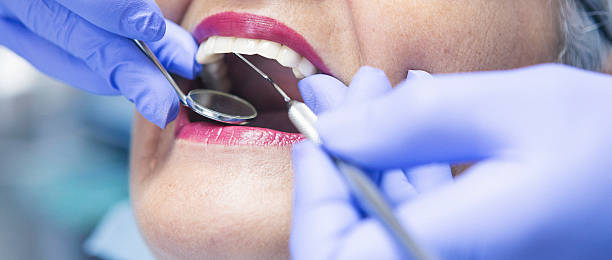Emergency Dental Filling Replacement in TX