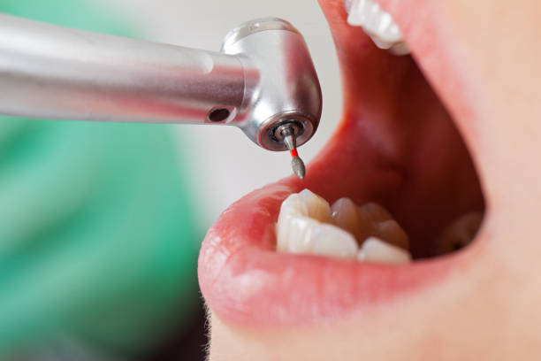 Best Tooth Infection Emergency Dentist  in Calvert, TX